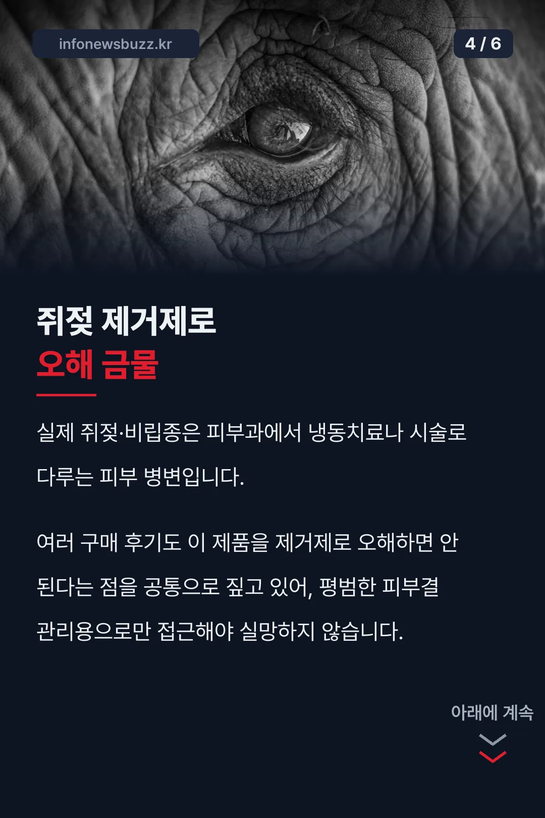 쥐젖 제거제 오해 바로잡기